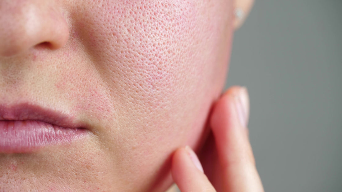 SKIN BARRIER: WHAT IS IT AND HOW TO FIX IT?